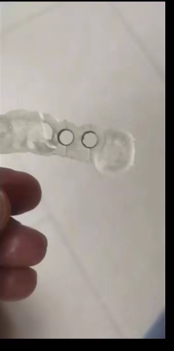 Resin Dental 3D Printer Planti - 3D Printing Guide review and price